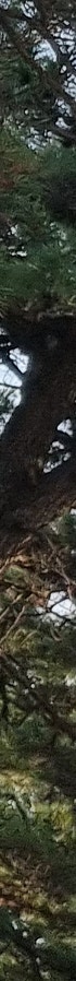 김해코성형 복코 휜코 유형 맞춤 개선방법 사진 23