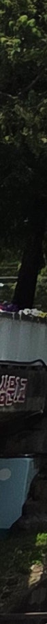 김해가슴성형 전후 유방초음파 중요성 체크 사진 8